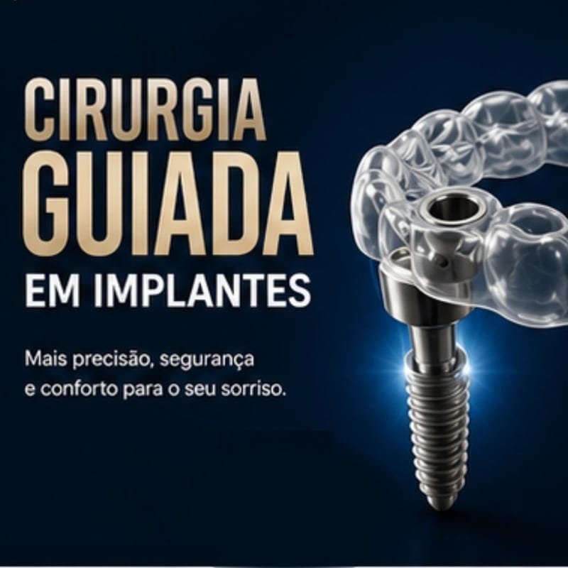 Cirurgia guiada em implantes, mais precisão e conforto