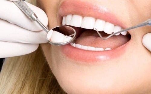 Consulta de prevenção e cuidado periodontal
