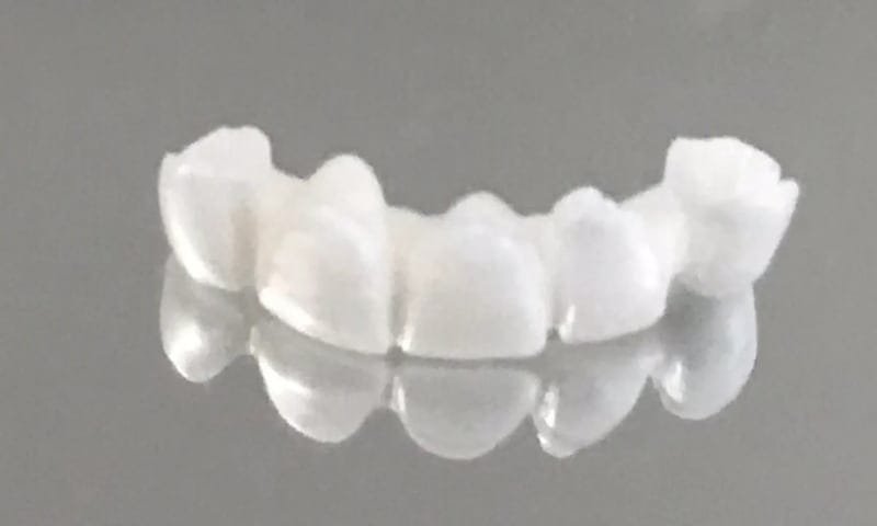 Prótese em porcelana branca sobre superfície espelhada