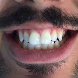 INICIAL