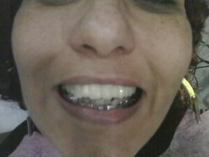 INICIAL
