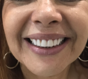 SORRISO