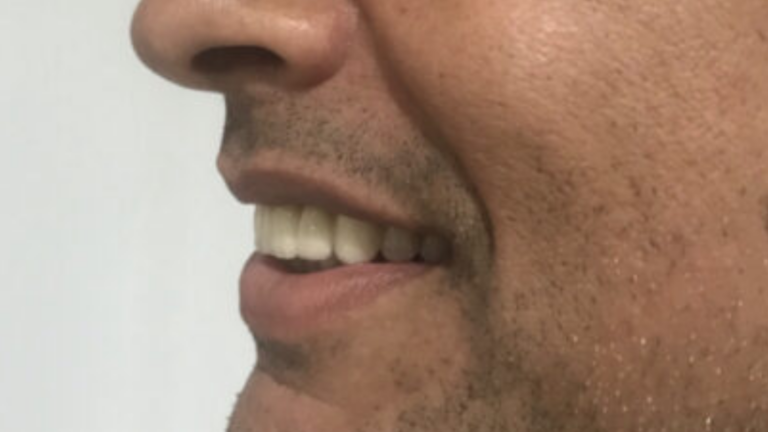 VISÃO LATERAL FINAL